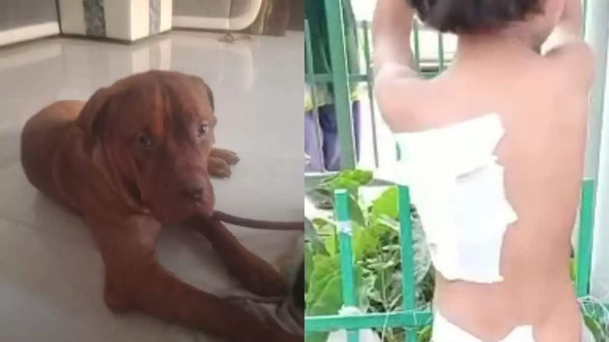 UP: लखनऊ में 5 साल की बच्ची पर ‘फ्रेंच मास्टिफ’ कुत्ते का हमला, शरीर पर कई घाव 