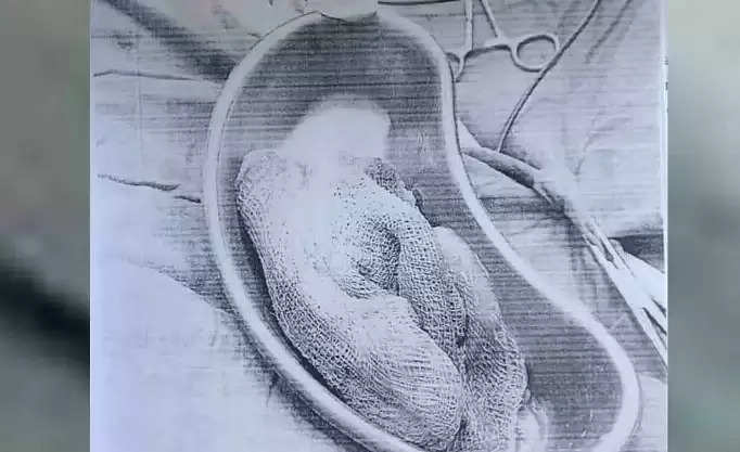 कानपुर CHC में प्रसव के दौरान बड़ी लापरवाही, गर्भवती के ऑपरेशन में पेट में छूटी पट्टी, हालत बिगड़ी