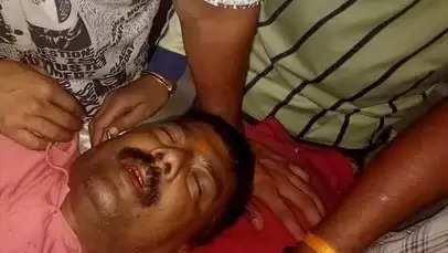 कानपुर के निर्दलीय प्रत्याशी के पति को मारी गोली, स्कूटी पर सवार थे दो बदमाश, पुलिस बोली- मामला संदिग्ध